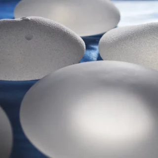 The importance of tissue based planning in breast augmentation surgery